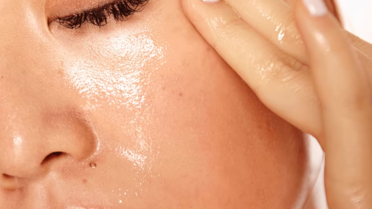 دليل العناية بالبشرة الدهنية وحب الشباب في الجزائر 2026