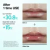 Anua-PDRN-Lip-Serum-10ml-1